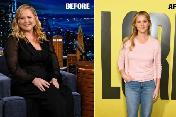 amy schumer weight loss